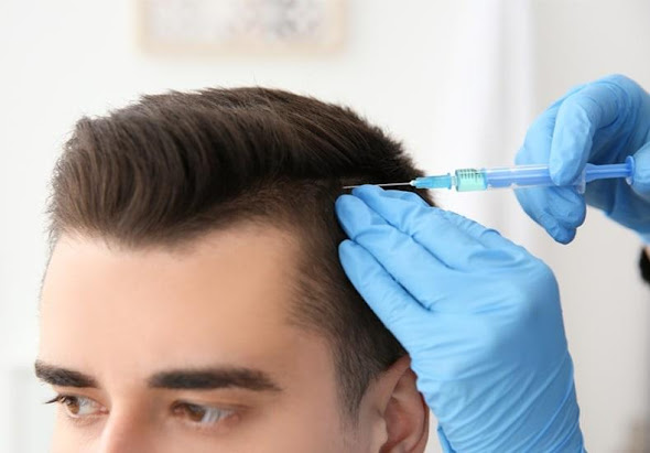 https://www.coherentmarketinsights.com/market-insight/androgenetic-alopecia-treatment-market-4316