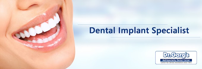 How to Find Dental Implant specialist in Delhi India? 
