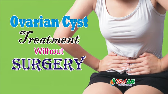 Ovarian Cyst Treatment Without Surgery