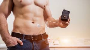 Insulin Pumps at the Forefront-Enhancing Diabetes Care