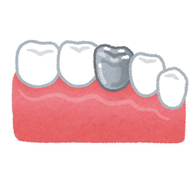 銀歯のイラスト 歯の治療 かわいいフリー素材集 いらすとや