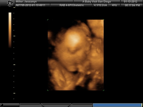 BABY_18.JPG BABY 18