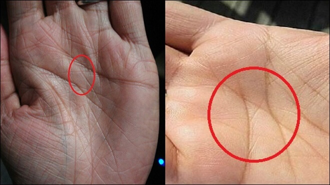 What It Means If You Have The Letter X On Both Your Hands