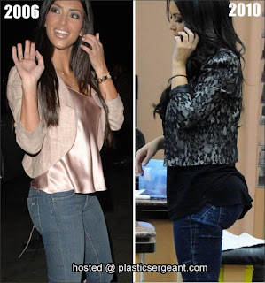  Kardashian Fake Boobs on The Rabbit S Rabbit  Has Kim Kardashian Had Surgey    Before And After