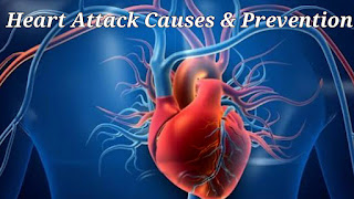 Heart Blockage: हार्ट ब्लॉकेज का इलाज | हार्ट अटैक से बचाव