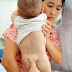Baby born with a tail [spina bifida] in Chaina 