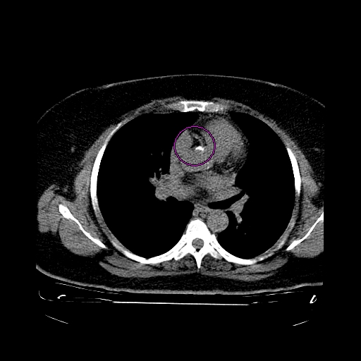 Heart scan curiosities: Heart Scan Curiosities #7