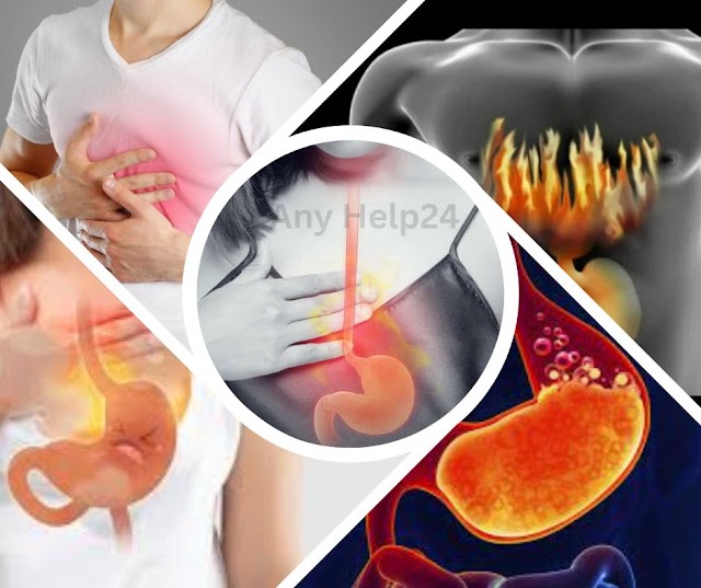 বুক জ্বালা / অম্লরোগ /Acidity/ Heart burn কি?কারন,লক্ষণ ও উপসর্গ, এবং চিকিৎসা।