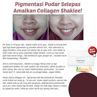 Kominasi Vitamin Hebat Untuk Kulit Sihat, Cantik Dan Anjal.