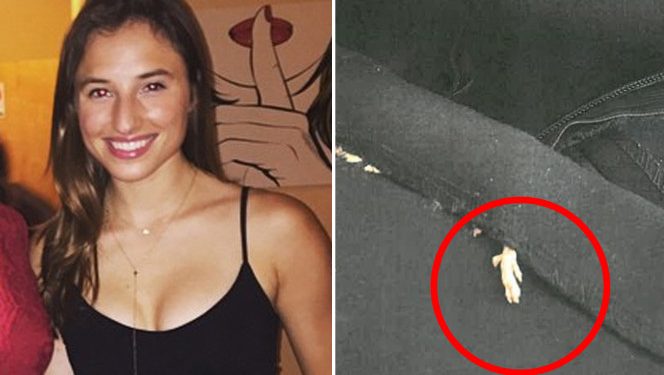 Shocking : This Woman Found Mouse Sewn In Her New  Zara Dress