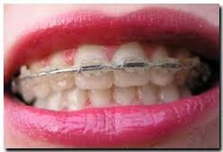 orthodontics