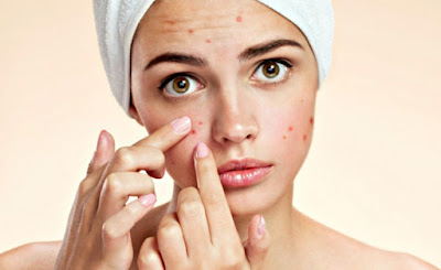 cura para el acne