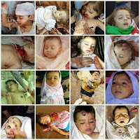 Israel shells Gaza hospital 