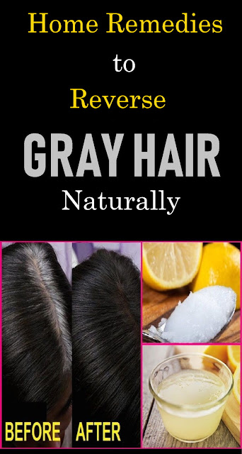 Home Remedies to Reverse Grey Hair Naturally