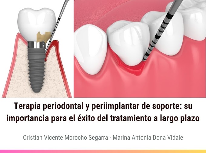 PDF: Terapia periodontal y periimplantar de soporte: su importancia para el éxito del tratamiento a largo plazo