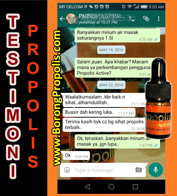 propolis active testimoni, avail propolis, stokis propolis active, penawar buasir berdarah