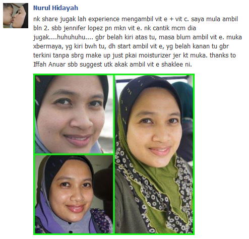 Image result for testimoni vitamin e shaklee