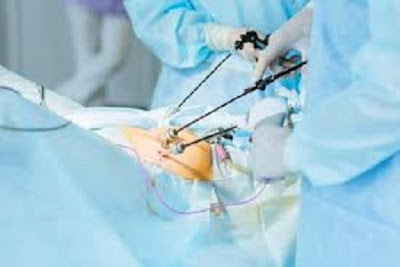 Laparoscopic Surgery In Thane West 