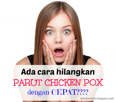 Cara Hilangkan Parut Chicken Pox Dengan Cepat - Healthy is 