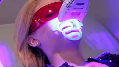 Tẩy trắng răng bằng đèn plasma có hại hay không?