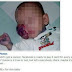 Facebook: Η απάτη με τις φρικιαστικές φωτογραφίες άρρωστων μωρών που ζητούν βοήθεια!