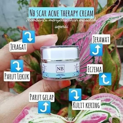 NB SCAR ACNE THERAPY CREAM RM25 (TRIAL 5G) & RM45 (SET 