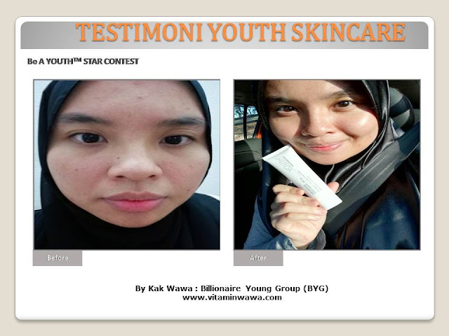 34 Testimoni Youth Skincare Shaklee Terbaru, Youth skincare shaklee, testimoni youth skincare shaklee, Youth Skincare Shaklee : Harga dan Review Pengguna Youth Shaklee, testimoni youth skincare shaklee, testimoni youth skincare shaklee