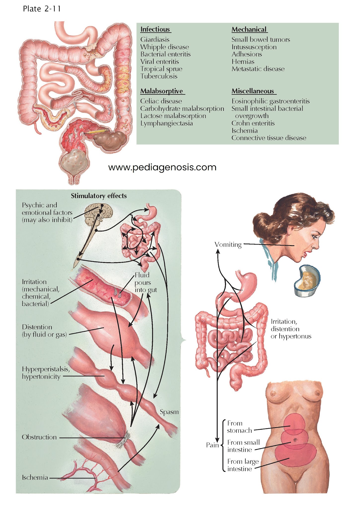 Pathophysiology of Small Intestine