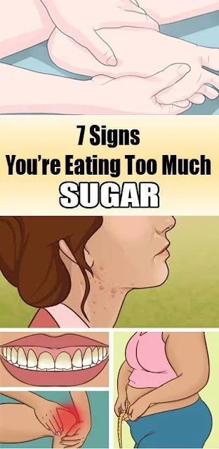 7 Signs You Are Eating Too Much Sugar