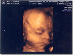Griffin-26weeks(2)