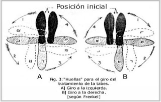 Resultado de imagen para frenkel ataxia