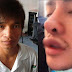 Benci Dengan Wajahnya Sendiri, Seorang Pria Asal Thailand Lakukan Operasi Plastik 30 Kali. Hasilnya?