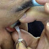 Invento japonés crean Gadget para colocar y retirar lentes de contacto sin tocarse globo ocular
