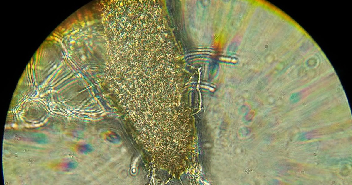  Gambar  Jamur  Pada Tempe  Dilihat Dari Mikroskop Pedro gambar 