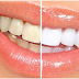 What Are The Reasons And Treatment For Tooth Discoloration?
