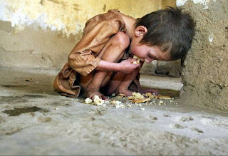 5 kasus kelaparan paling parah di dunia