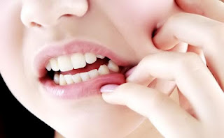10 Cara Mengobati Sakit Gigi Yang Berlubang - Ada Yang Asik