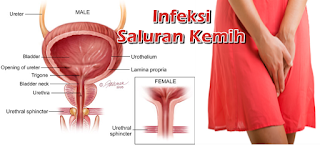 http://de-natur-indonesia.blogspot.com/2017/06/obat-kencing-perih-tetes-terakhir.html