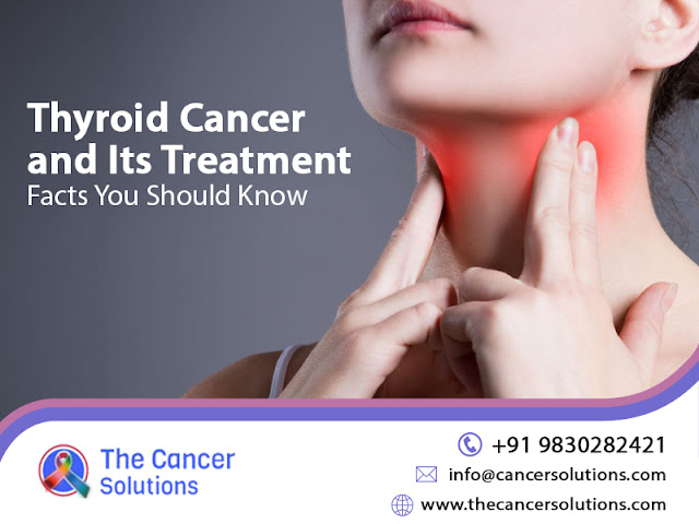 thyroid cancer doctor in Kolkata