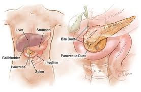 pancreatic cancers, pancreatic cancer survival, what is the treatment for pancreatic cancer, treatment of pancreatic cancer, treatment pancreatic cancer, pancreatic cancer treatment, treatment for pancreatic cancer, survival rate of pancreatic cancer, survival rate pancreatic cancer, survival rate for pancreatic cancer, pancreatic cancer survival rate, pancreas cancer survival rate, survival rates pancreatic cancer, survival rates of pancreatic cancer, survival rates for pancreatic cancer, pancreatic cancer survival rates, causes for pancreatic cancer, what are the causes of pancreatic cancer, causes of pancreatic cancer, pancreatic cancer causes of, pancreatic cancer causes, what causes pancreatic cancer, causes pancreatic cancer, pancreatic cancer cause, the cause of pancreatic cancer, what cause pancreatic cancer, cause pancreatic cancer, cause of pancreatic cancer, stage 4 pancreatic cancer, pancreatic cancer stage 4, prognosis for pancreatic cancer, prognosis of pancreatic cancer, pancreatic cancer prognosis, prognosis pancreatic cancer, what is the prognosis of pancreatic cancer