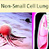 Non-small-cell lung carcinoma