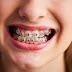 Cuidados essenciais com os dentes das crianças