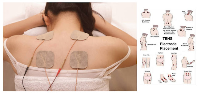 Tens Electrical Therapy for Back Pain