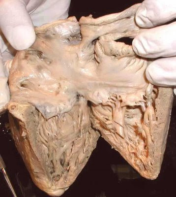 human heart