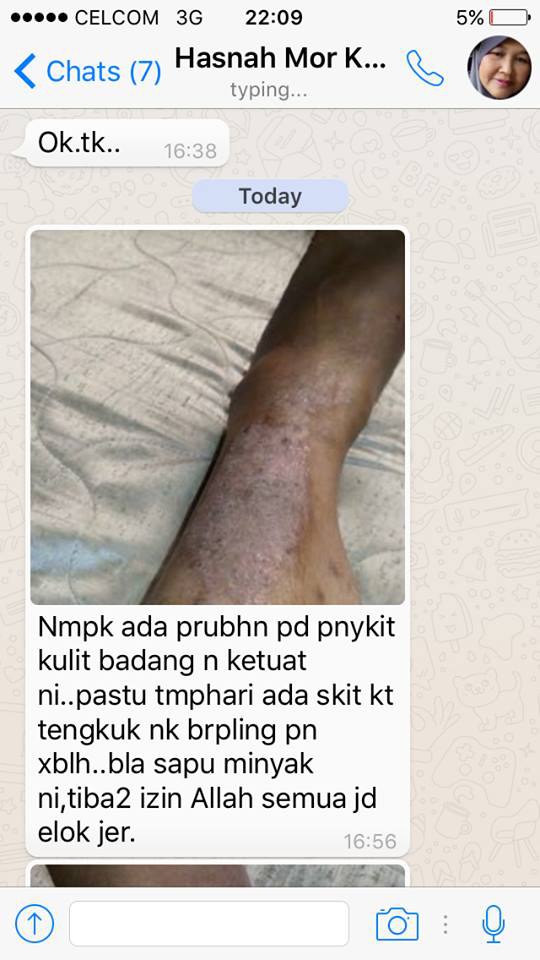 Minyak Morha ®: Testimonial Pengguna Minyak Morha (Morhabshi)