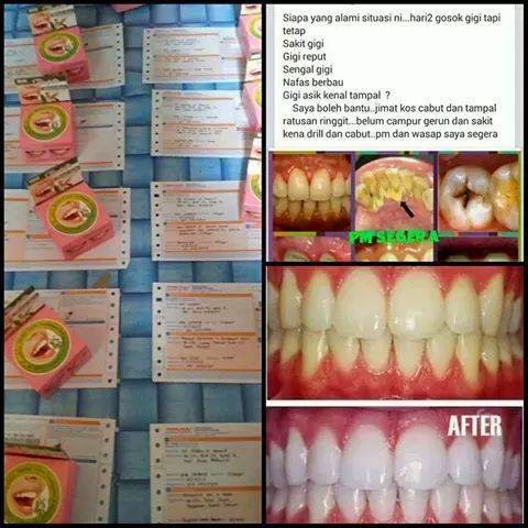 Kintan aishah: RASYAN HERBAL CLOVE TOOTHPASTE - UBAT GIGI 