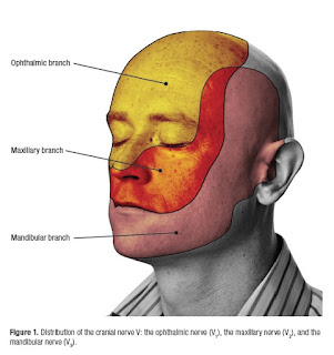 Possible Nursing Diagnosis for Trigeminal Neuralgia