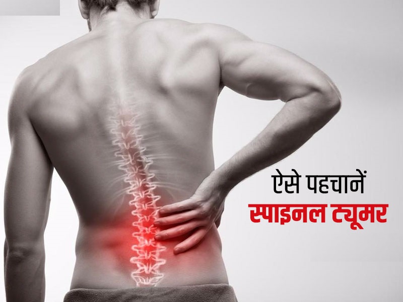 Spine tumor treatment cost in mumbai