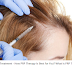 Hair Loss Treatment - How PRP Therapy Is Best for You? What Is PRP Therapy? | beauty blog usa