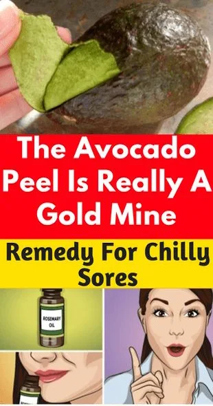 The Avocado Peel Is Really A Gold Mine, A Pure Remedy For Chilly Sores!!!